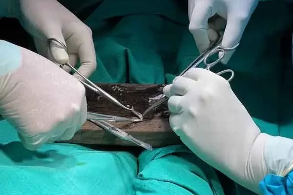 Une greffe de peau pour un ulcère à l'hôpital de Mission Lèpre à Purulia.